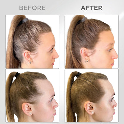 THICK FIBER Root Touch Up and Hairline Concealer - Water & Sweat Resistant Hair Loss Powder Set for Thinning Hair, Includes Brush (Light Brown)