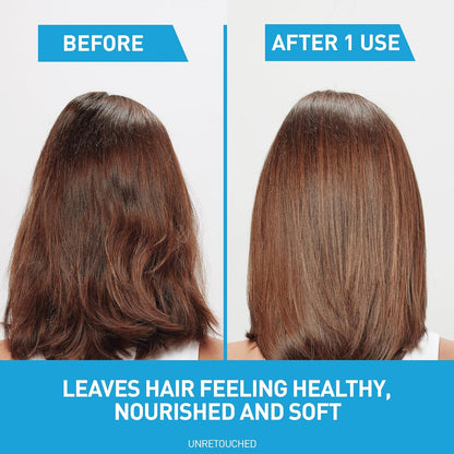 CeraVe Hydrating Anti Dandruff Shampoo, 1% Pyrithione Zinc Dandruff Treatment With Ceramides, Niacinamide & Hyaluronic Acid, Helps Eliminate Flakes & Provides Itchy Scalp Relief, Sulfate Free, 12 Oz