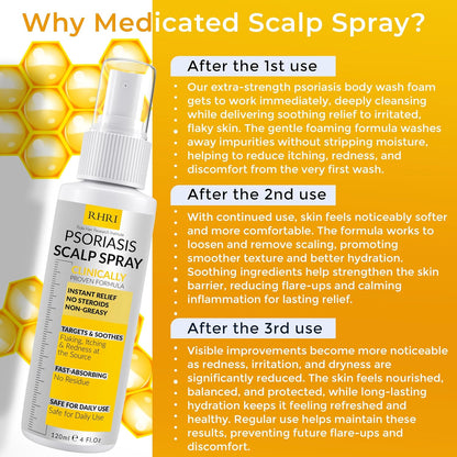 Psoriasis Scalp Spray | Psoriasis and Dandruff Treatment for Scalp Yeast Infections, Psoriasis Flare-Ups & Folliculitis | Antifungal Ringworm Itchy Scalp Spray for Psoriasis, Dryness