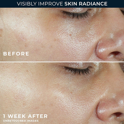 RoC Multi Correxion Revive + Glow Vitamin C Sunscreen Broad Spectrum SPF 30 Face Moisturizer (1.7 oz) with Retinol Eye Cream Packette