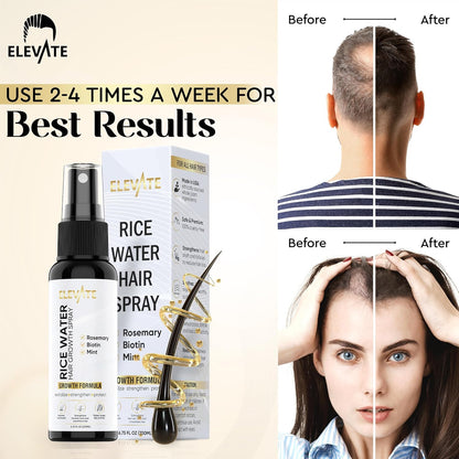Elevate Rice Water Spray for Hair Growth - Fermented Rice Water & Rosemary Hair Mist with Biotin - Vegan Leave-In Treatment for Stronger, Thicker, Healthier Hair - Scalp Care for Women & Men