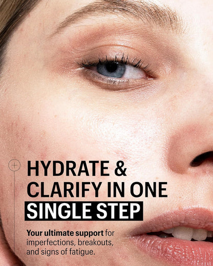 Allies of Skin Multi Nutrient & Dioic Renewing Cream: Moisturizer with Dioic Acid, 14 Antioxidants, Probiotics & Centella Asiatica. Targets Imperfections, Brightens & Protects Skin 1.7 oz / 50 ml