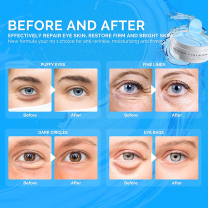 Under Eye Patches for Dark Circles: 30 Pairs Enaskin Naturals Retinol Collagen Eye Gels Mask - Reduce Wrinkles Puffy & Bags - Skin Treatment Pads - Anti Aging Moisturizer For Women (Blue)