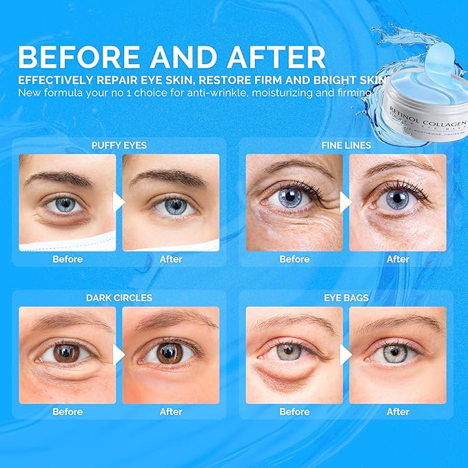 Under eye patches for dark