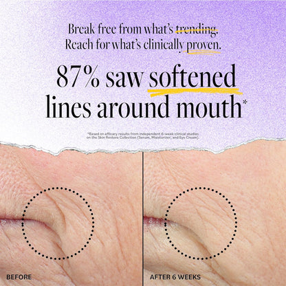 DERMA E Advanced Peptides and Vegan Flora-Collagen Serum – Double Action Collagen Face Cream with Peptide Complex – Intensely Hydrating Serum for Lines, Wrinkles and Redness, 2 oz